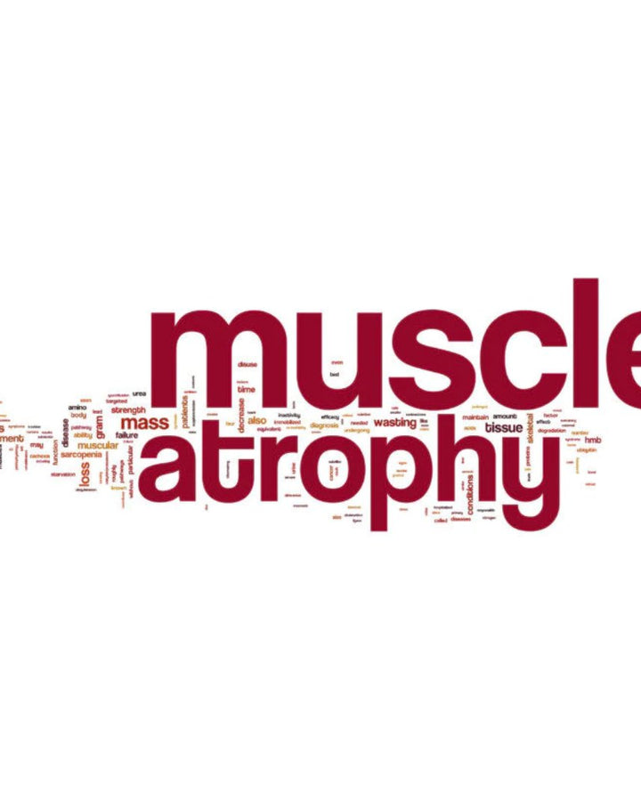 SMA - Spinal Muscular Atrophy