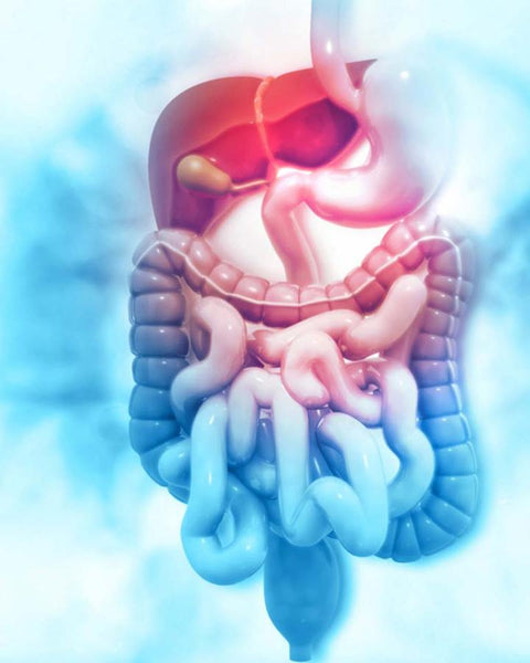 Импульсная эвакуация орошения (PIE) для нейрогенной кишки - трансановое орошение (TAI)