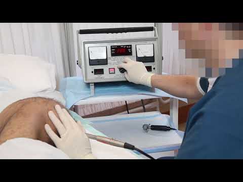Vibratrice haute fréquence Ferticare 2.0 pour Ed et Sci Ejaculation - Expédition gratuite des États-Unis! Nous expédions dans le monde entier!